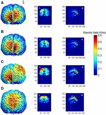 Multi-session Transcranial Direct Current Stimulation Over Primary Motor Cortex Facilitates Sequence Learning, Chunking, and One Year Retention